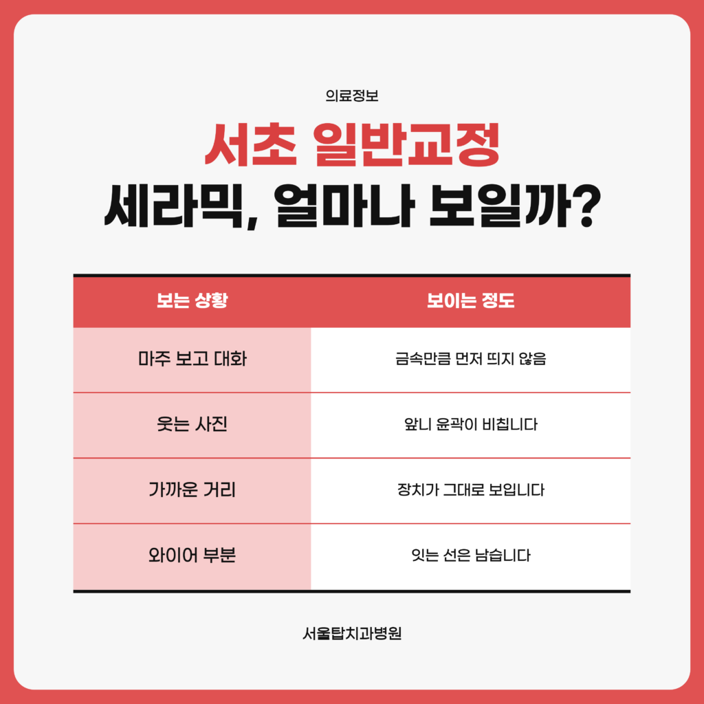 서초 일반교정에 쓰는 세라믹 자가결찰 장치가 보이는 정도를 정리한 서울탑치과병원 자료 이미지