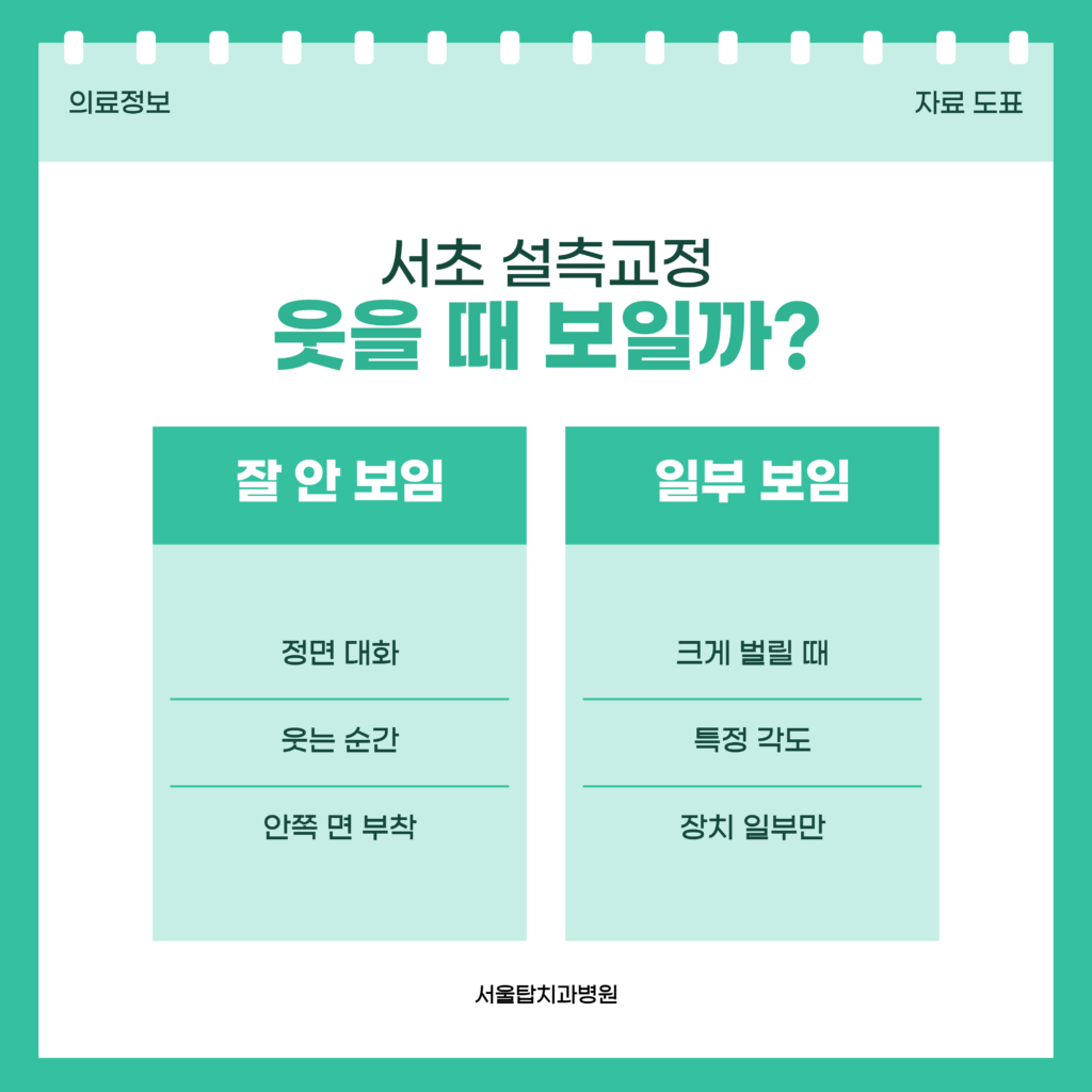 서초 설측교정 장치가 정면 대화와 웃는 순간에는 잘 드러나지 않고 입을 크게 벌릴 때와 특정 각도에서는 일부 보일 수 있다는 내용을 두 칸으로 정리한 자료 도표