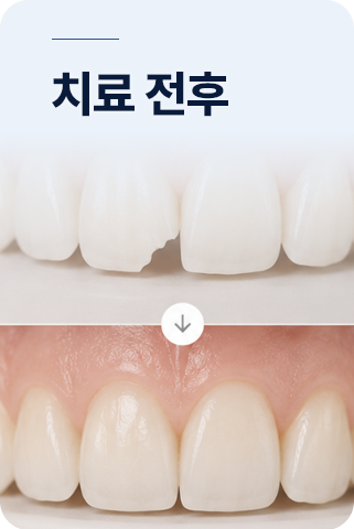 치료 전후